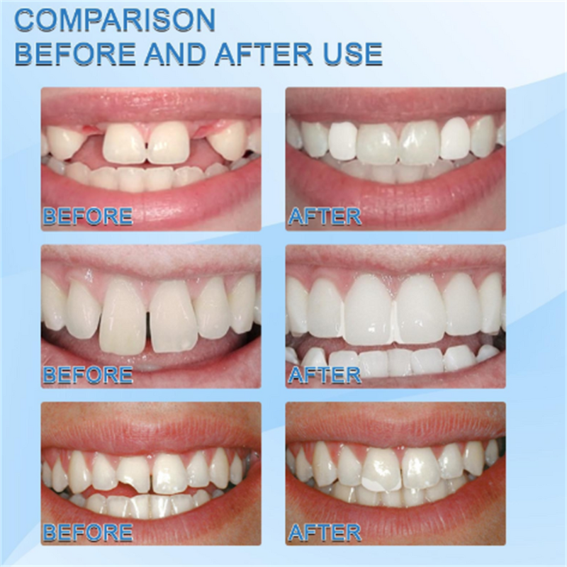 False Teeth Gel - OEM Moldable Temporary Fill Fix Missing Broken Teeth Gel