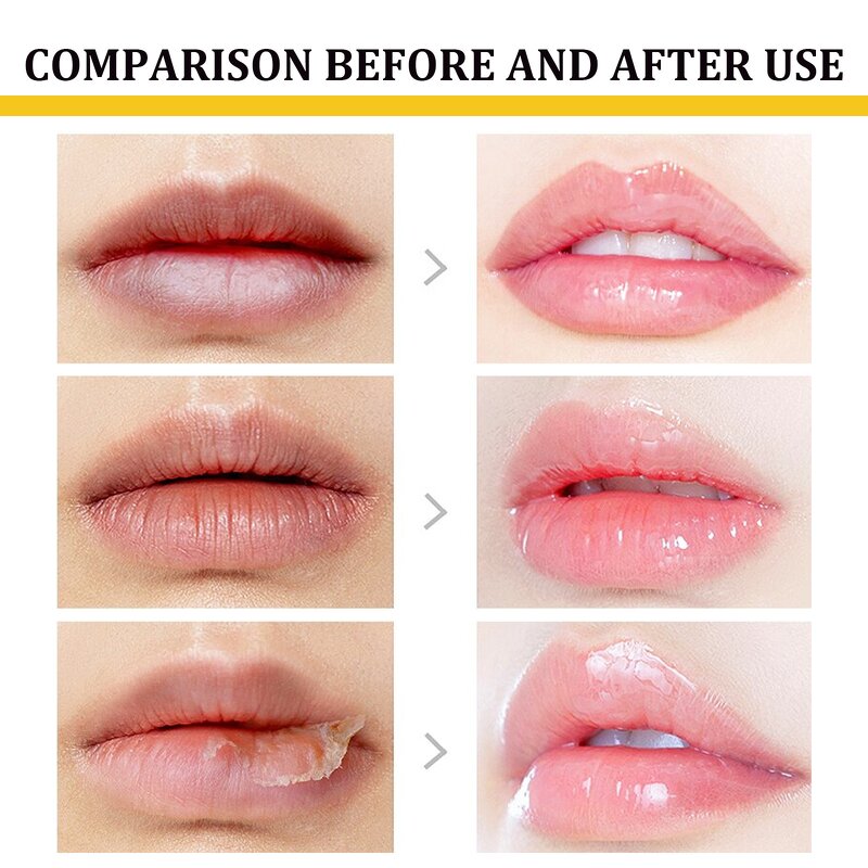 Lip Balm Factory - 10g Fade Lip Line Anti-Crack Moisturizing Anti Freeze