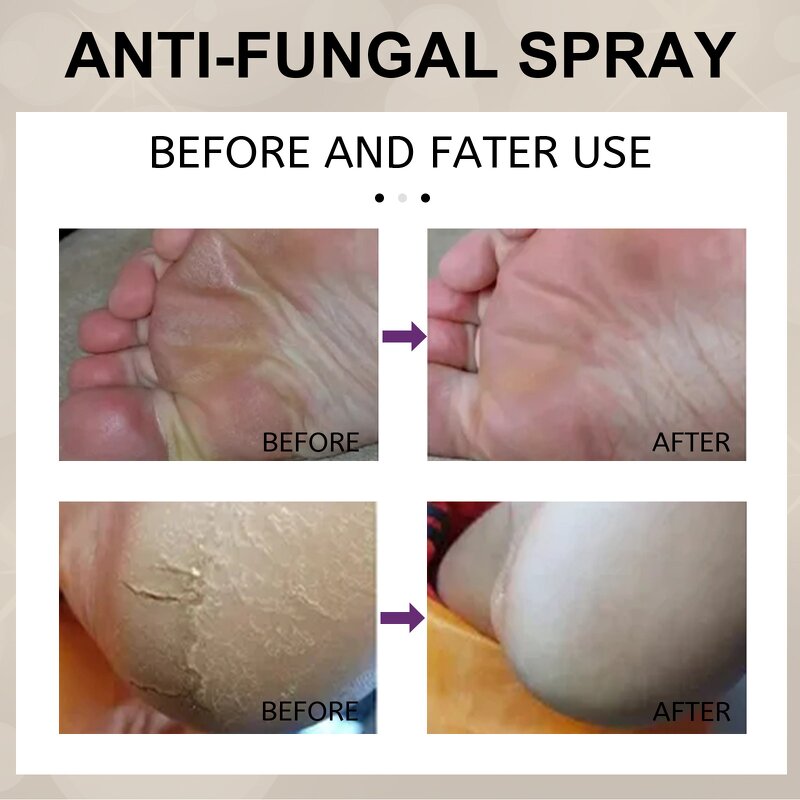 Foot Spray Factory - Moisturize Exfoliate Anti-itch Deodorant Nail Care