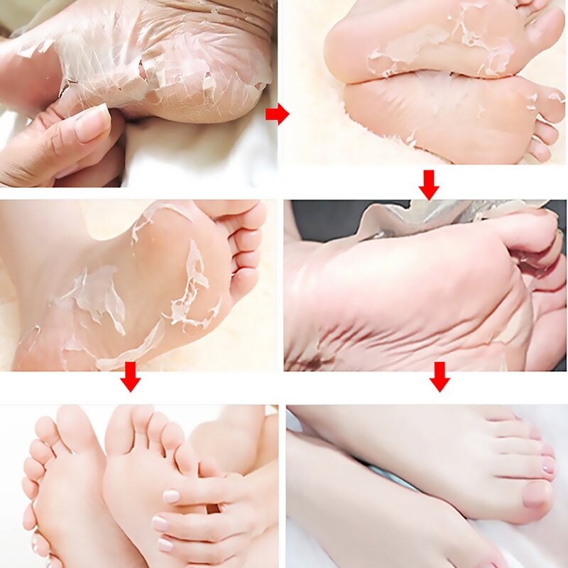 Foot Mask Manufacturer - OEM Fruit Acid Exfoliating Calluses Dead Skin Remover