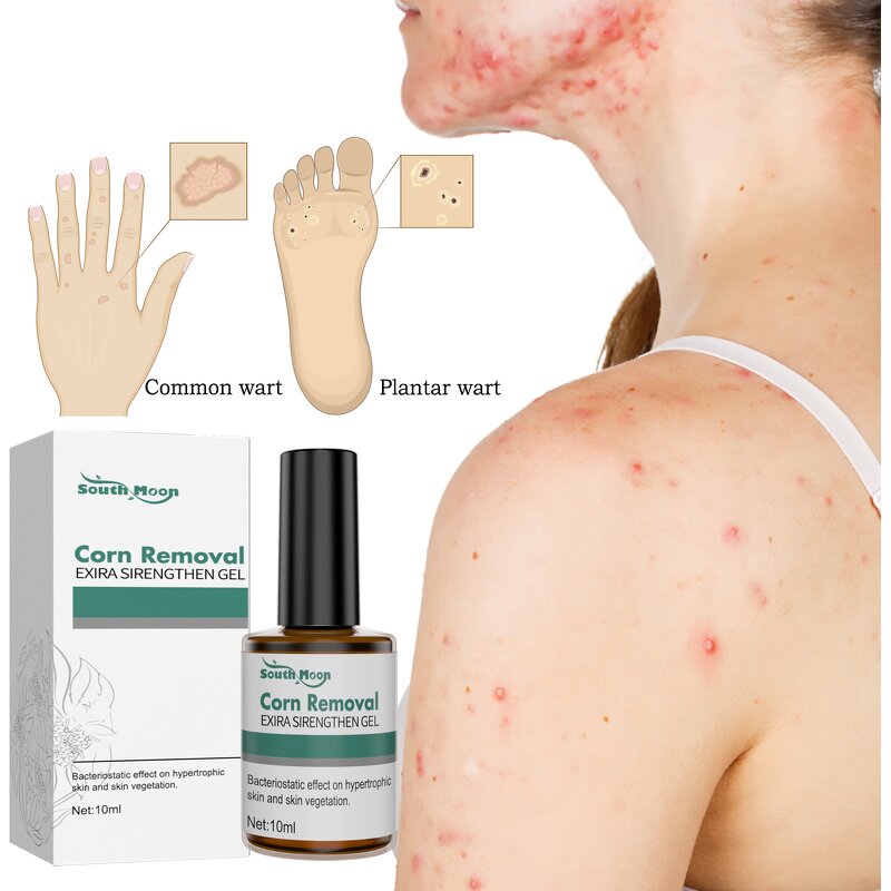 Skin Tag Wart Cream - OEM Herbal Extract Flesh Thorn Corn Removal Wholesale