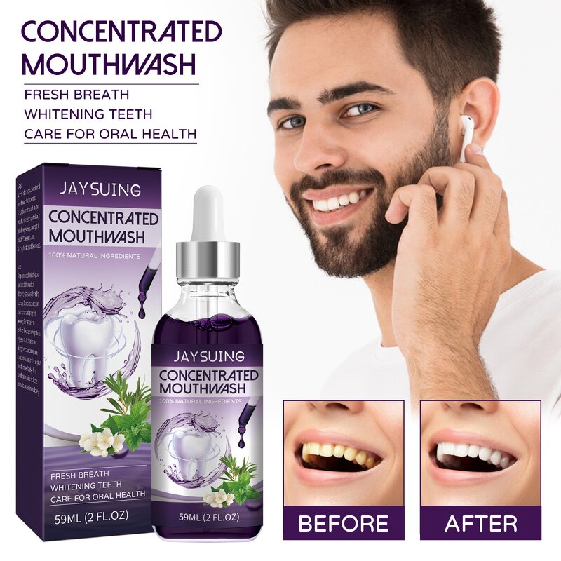 Concentrated Mouthwash - OEM Fresh Breath Stain Remove Gingival Pain Antiseptic