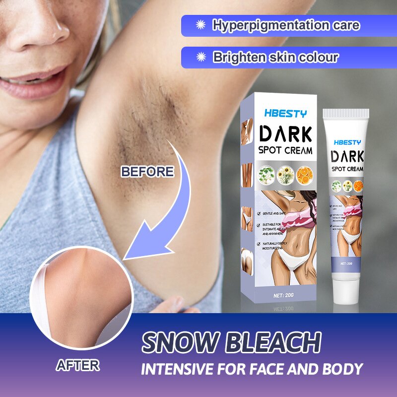 Dark Spot Cream - OEM 20G Intimate Area Body Whitening Spot Removal