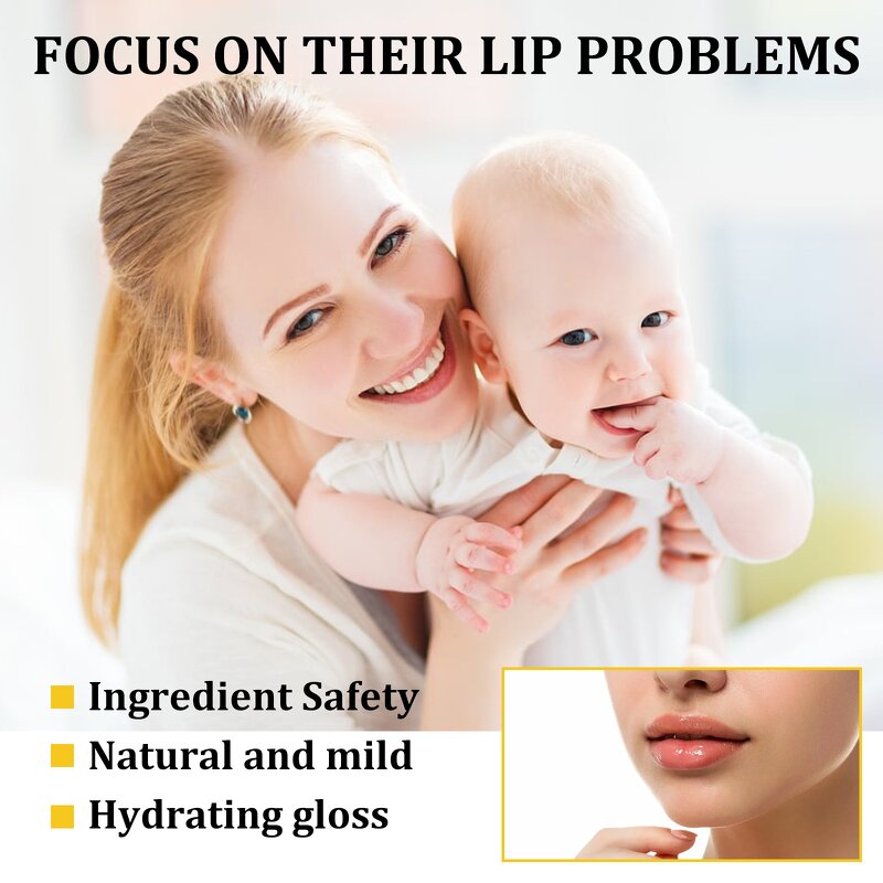 Lip Balm Factory - 10g Fade Lip Line Anti-Crack Moisturizing Anti Freeze