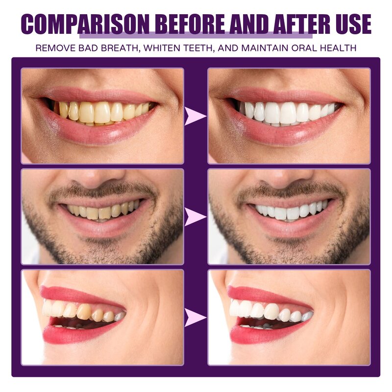 Concentrated Mouthwash - OEM Fresh Breath Stain Remove Gingival Pain Antiseptic