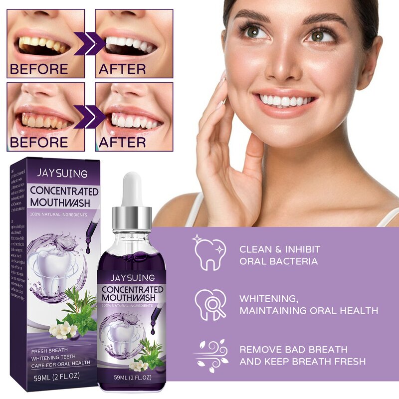 Concentrated Mouthwash - OEM Fresh Breath Stain Remove Gingival Pain Antiseptic
