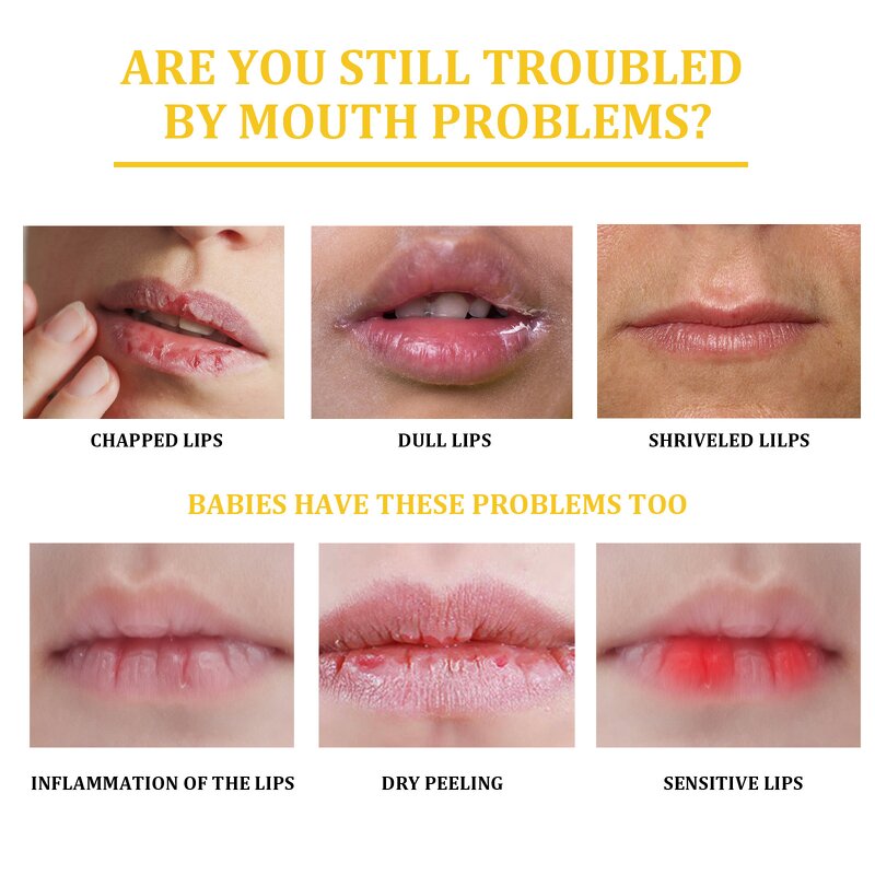 Lip Balm Factory - 10g Fade Lip Line Anti-Crack Moisturizing Anti Freeze