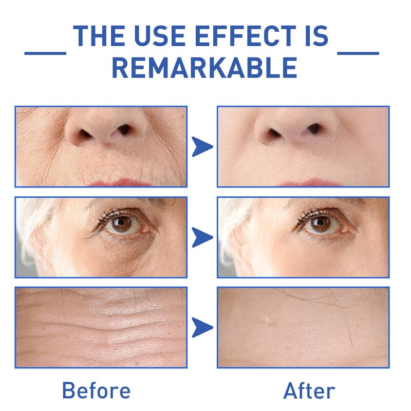 Peptide Serum - OEM Anti-Wrinkle Firming Lifting Dark Spot Erase Hydroconus