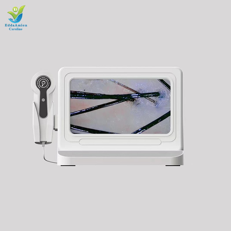 Hair Analysis Machine Supplier - HD 5 In1 AI Tester