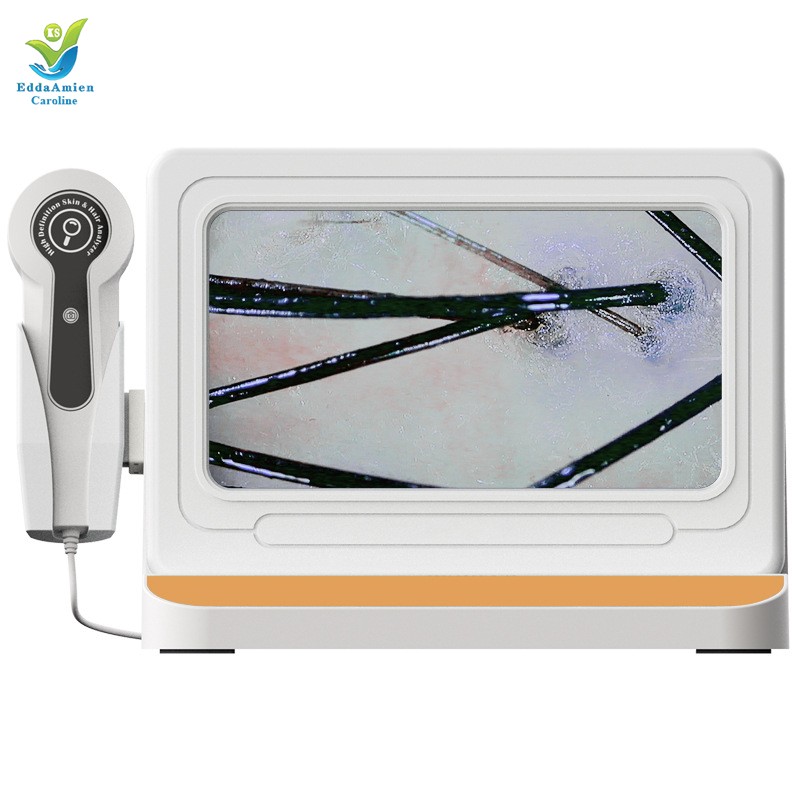 Hair Analysis Machine Supplier - HD 5 In1 AI Tester