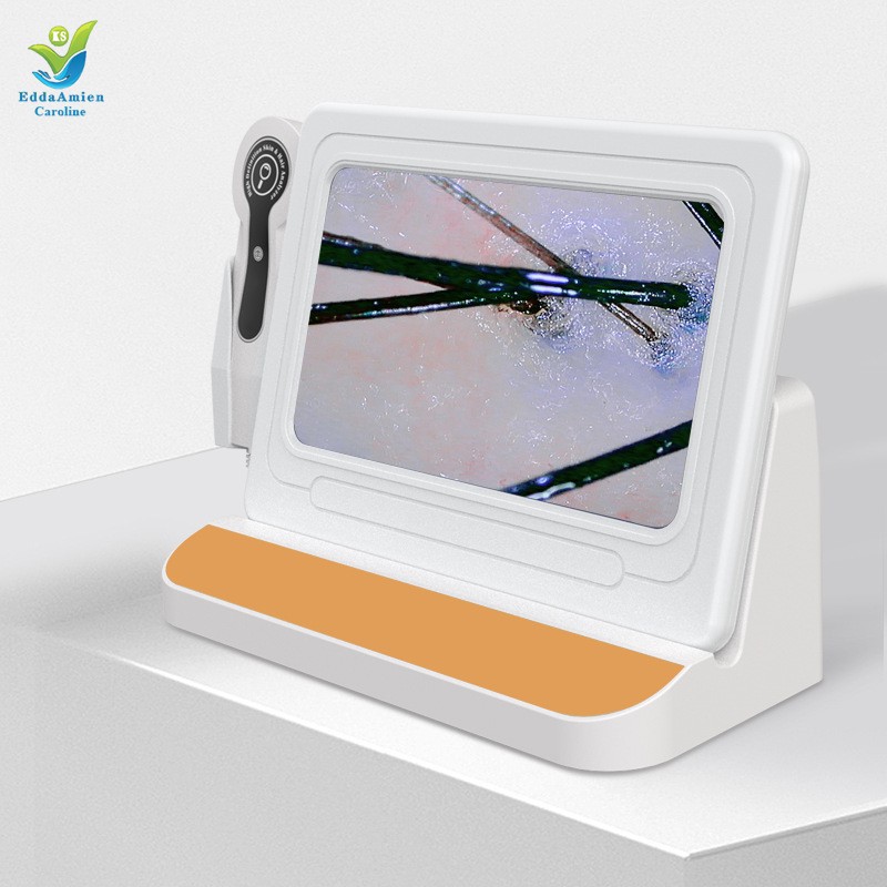 Hair Analysis Machine Supplier - HD 5 In1 AI Tester