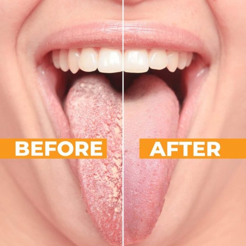 Tongue Cleaner Supplier - Pure Copper Reusable Scraper