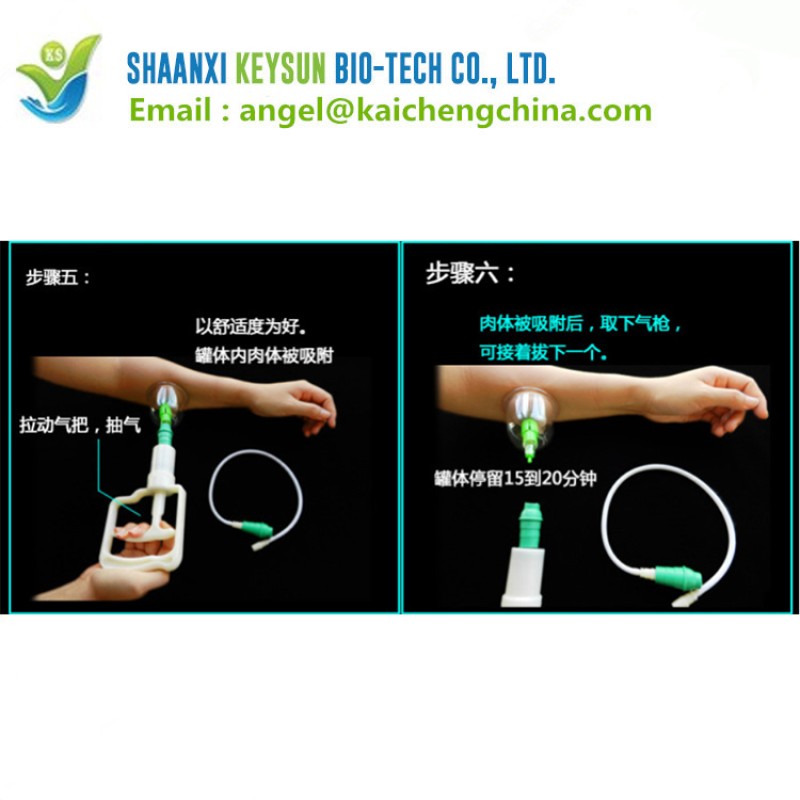 Vacuum Cupping Apparatus Supplier - Pull Out Vacuum Device