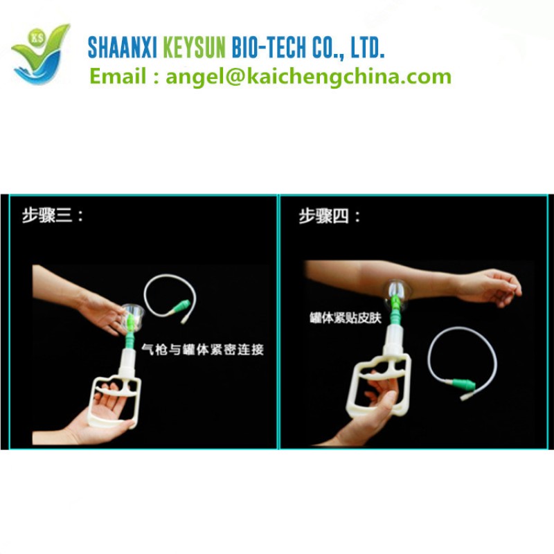 Cupping Cups Manufacturer - Hijama Vacuum Suction Set