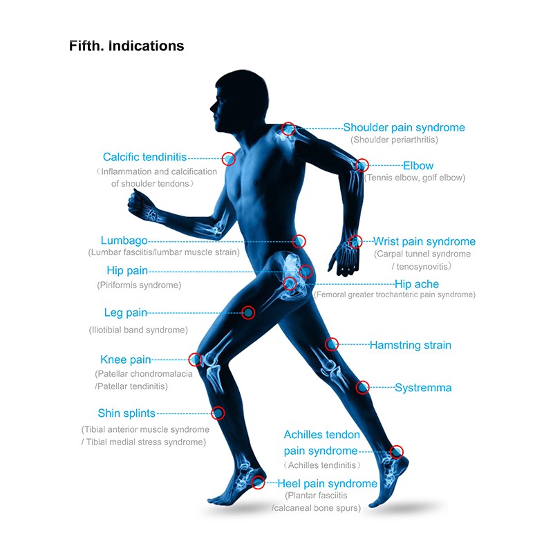 Shockwave Therapy Machine Manufacturer - Non-invasive Pain Relief
