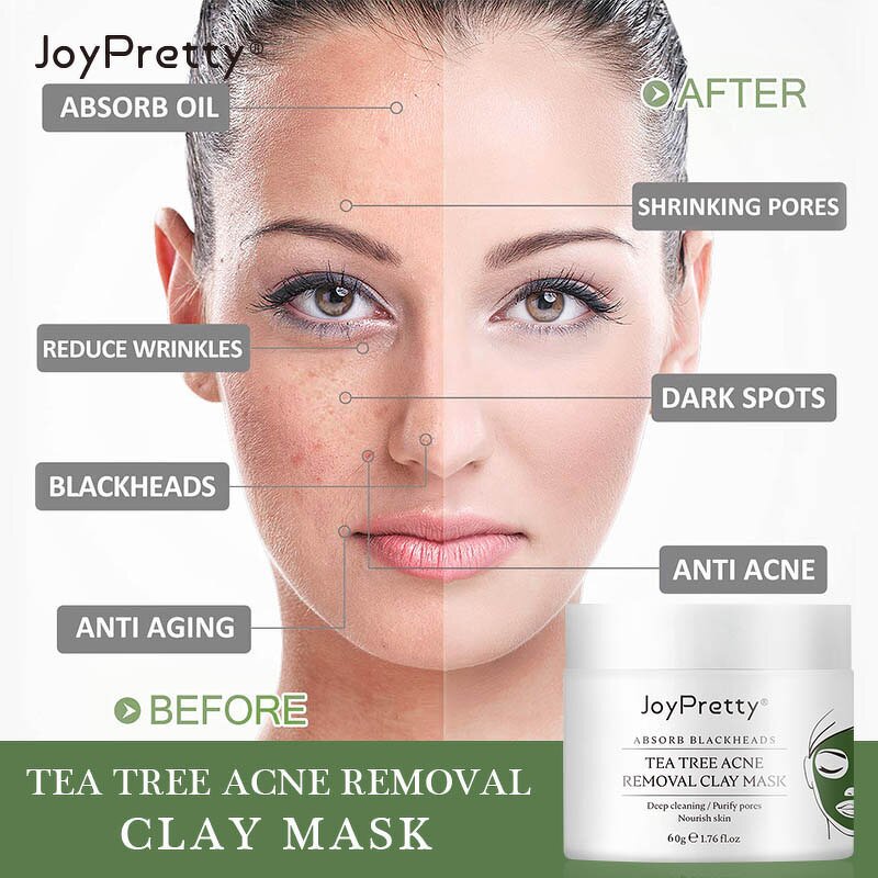 Tea Tree Clay Mask - Factory - Joypretty Organic Anti Acne Deep Cleansing Oil Control Moisturizing Mud Mask