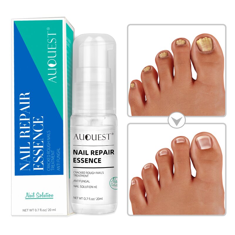 Nail Repair Spray - Factory - Wholesale New Arrival Cracked Dry Speed Growth Stronger Nail Serum