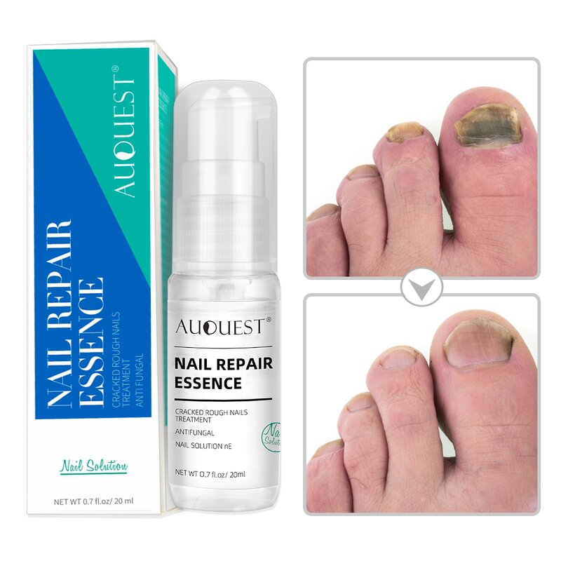 Nail Repair Spray - Factory - Wholesale New Arrival Cracked Dry Speed Growth Stronger Nail Serum