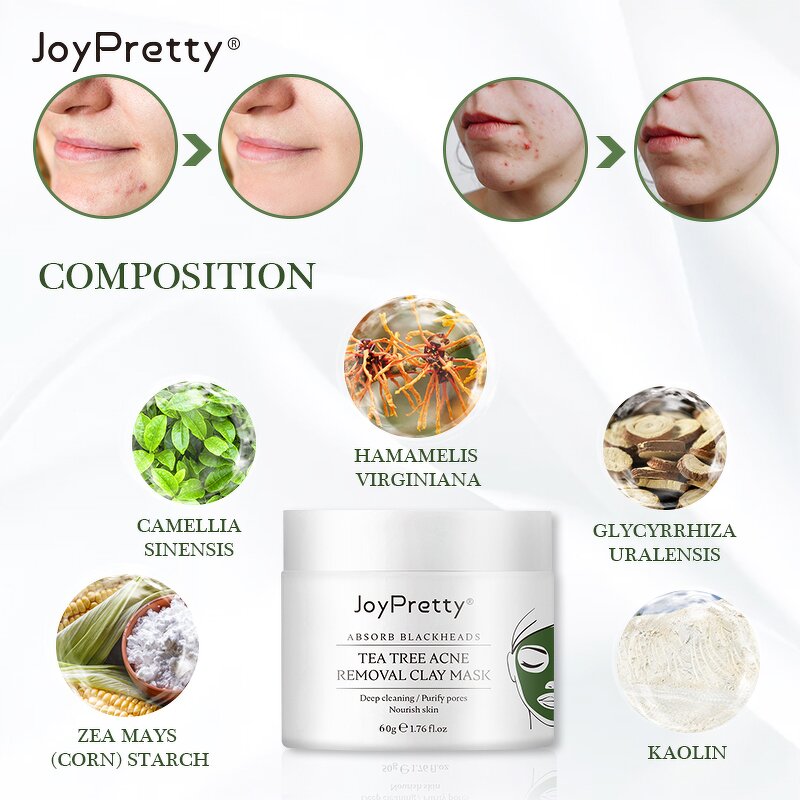 Tea Tree Clay Mask - Factory - Joypretty Organic Anti Acne Deep Cleansing Oil Control Moisturizing Mud Mask