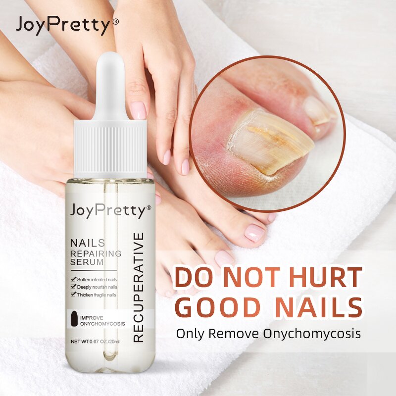 Fungal Nail Repair Serum - Manufacturer - Ready to Ship Remove Onychomycosis Toe Nourishing Nail Serum