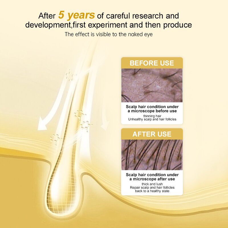 Anti Hair Loss Serum - Factory - Hot Selling Private Label Organic Herbal Scalp Repair Prevention Oil