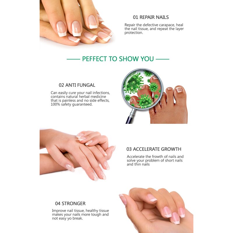 Fungal Nail Repair Serum - Factory - Private Label Feet Care Nail Fungus Removal Gel Anti Infection Serum