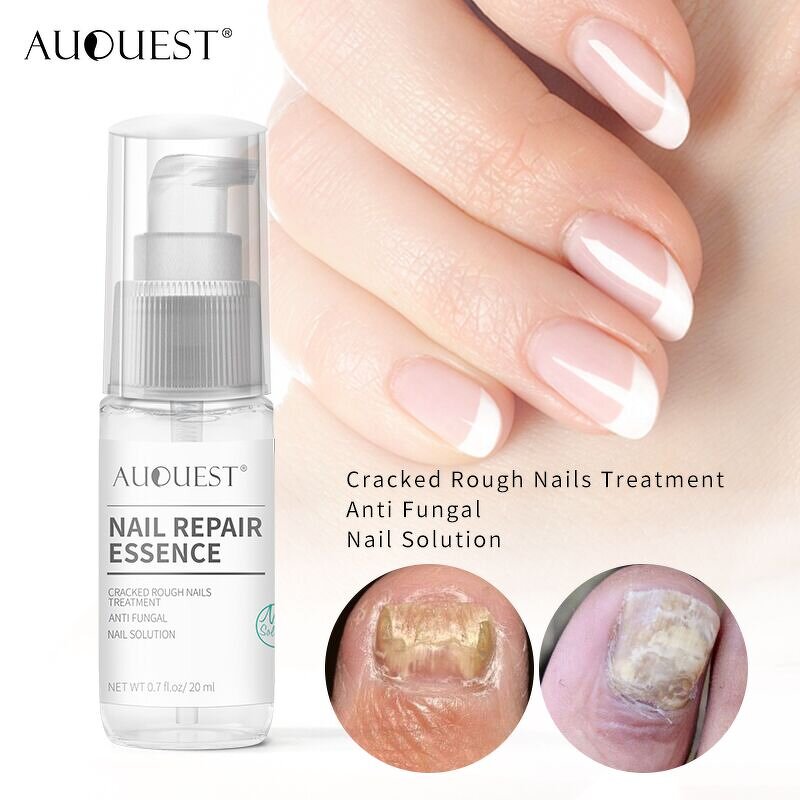 Nail Repair Spray - Factory - Wholesale New Arrival Cracked Dry Speed Growth Stronger Nail Serum