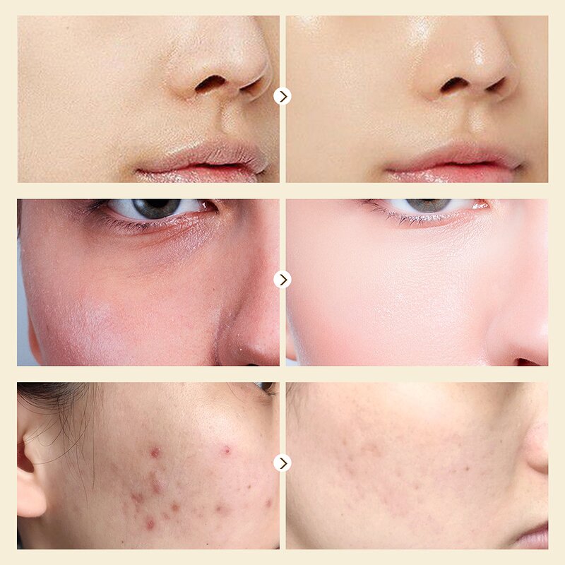 Snail Face Cream - Manufacturer - AuQuest Private Label Organic Moisturizing Collagen Whitening Anti Wrinkle