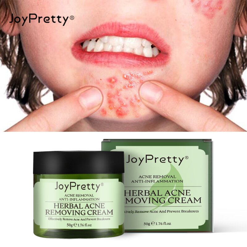 Tea Tree Acne Cream - Manufacturer - Joypretty Wholesale Organic Whitening Nourishing Anti Acne Cream
