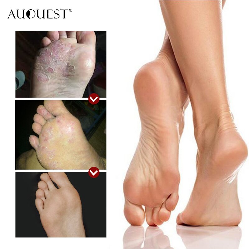 Horse Oil Foot Care - Manufacturer - Moisturizing Hydrating Anti Fungal Nail Repair Professional Foot Care