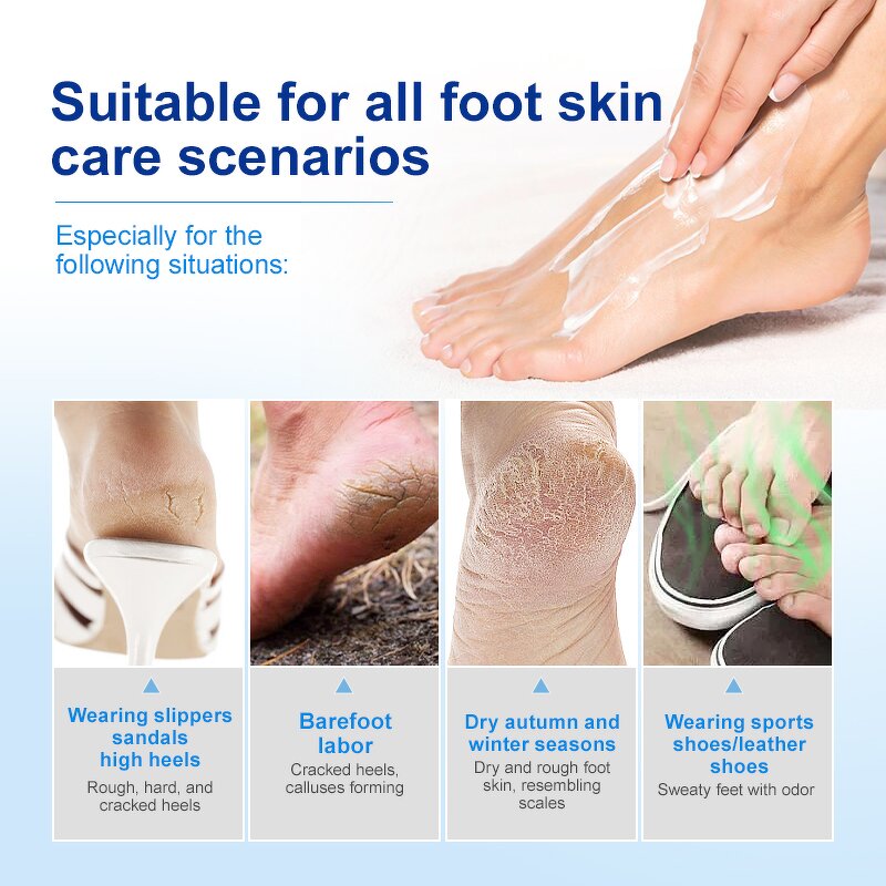 Urea Foot Cream - Manufacturer - Wholesale Organic 42% Cracked Heels Exfoliating Dead Skin Removal