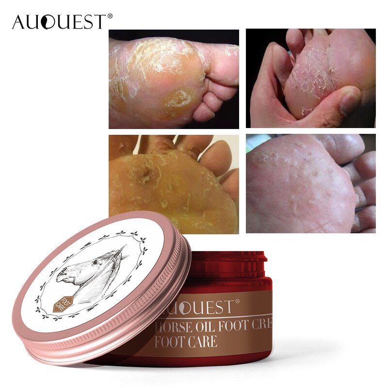 Horse Oil Foot Care - Manufacturer - Moisturizing Hydrating Anti Fungal Nail Repair Professional Foot Care