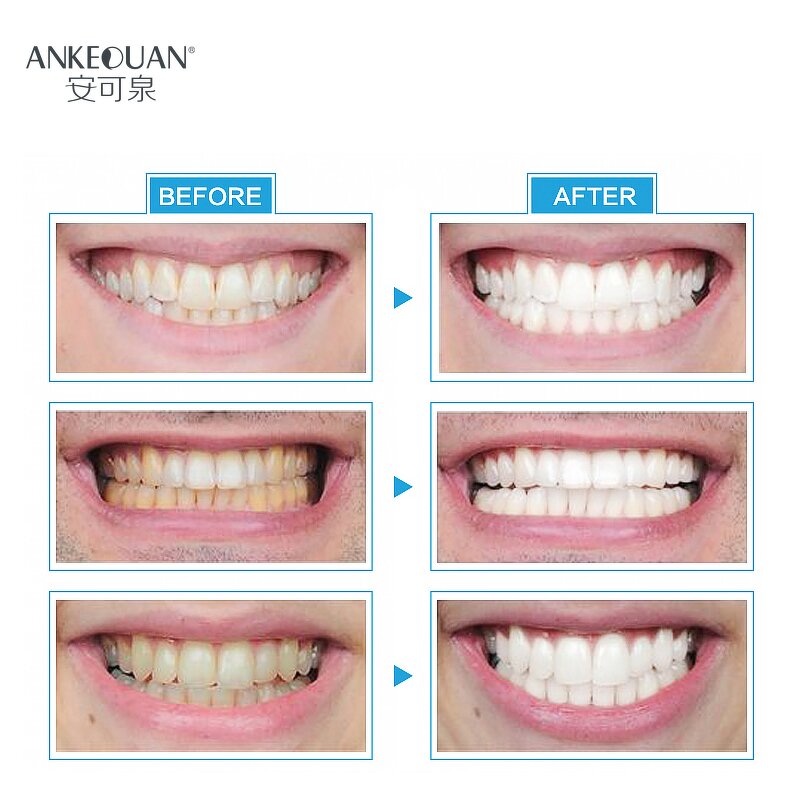 Teeth Whitening Mints - Factory - Best Products with Cool Light Customized Logo Teeth Brightening Mints