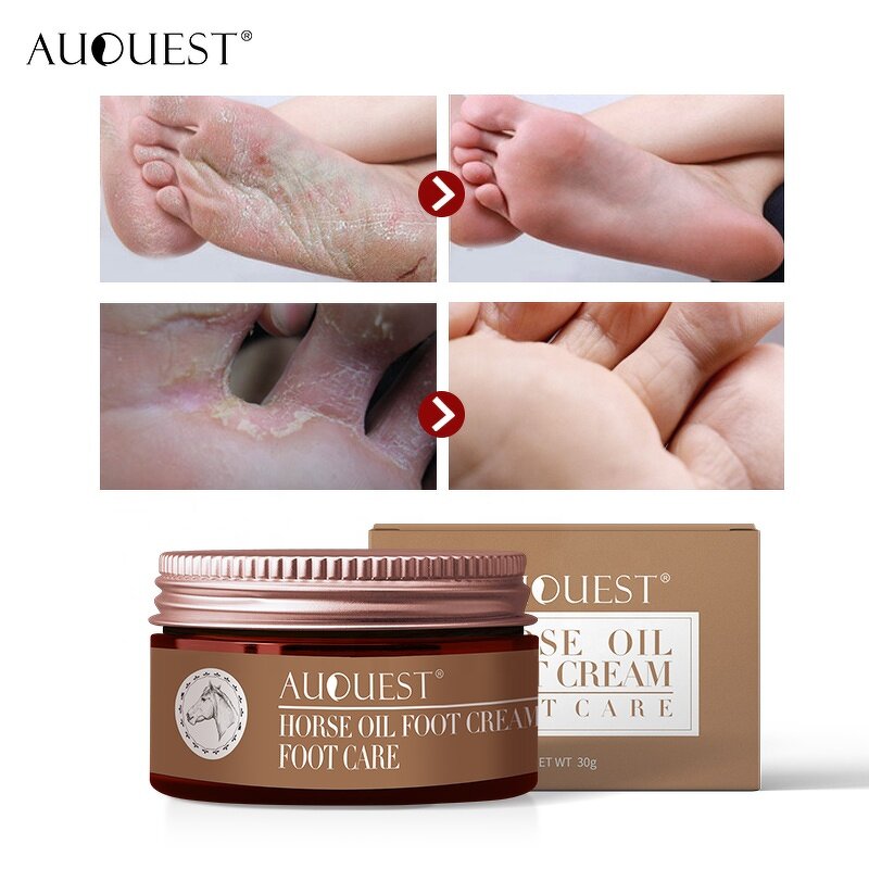 Horse Oil Foot Cream - Factory - Exfoliating Moisturizing Antifungal Dry Cracked Feet Hydrating Lotion