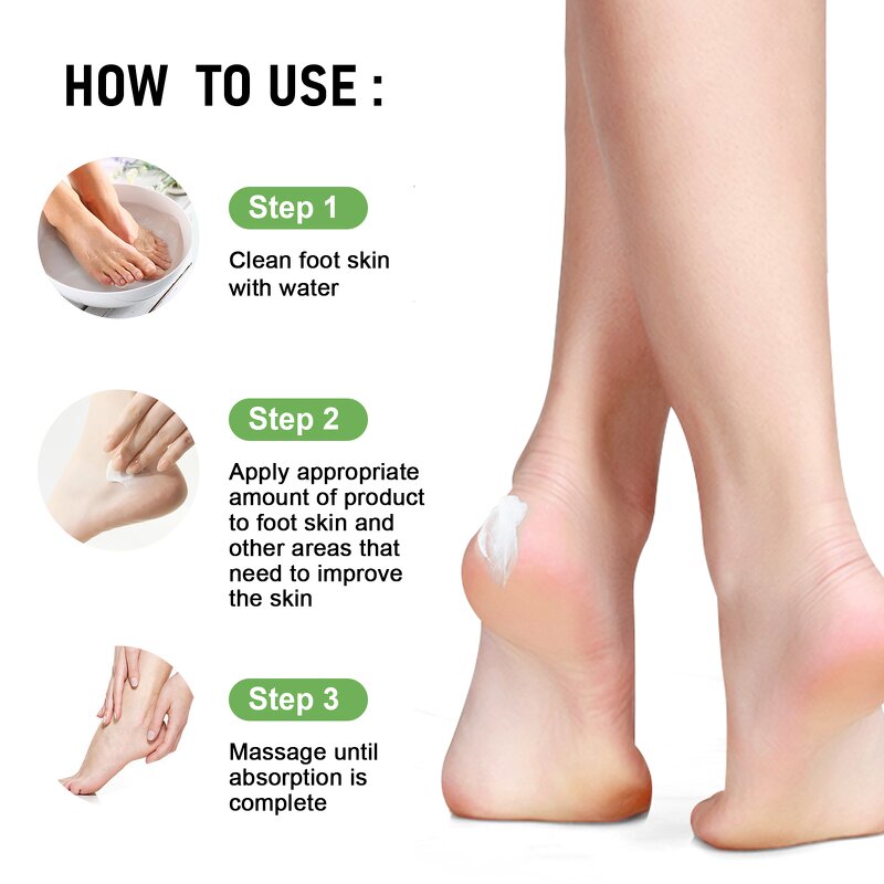 Urea Foot Cream - Factory - Hot Selling Private Label Organic Intensive Nourishing Hydrating Repair Cream