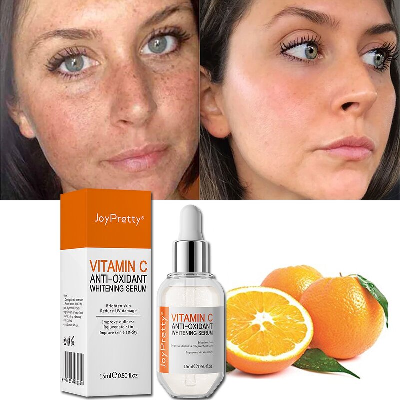 Vitamin C Skin Care Set - Manufacturer - Factory Direct Whitening Organic Anti Dark Spots Brightening Set