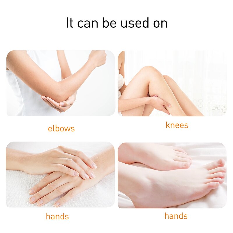 Foot Peeling Spray - Manufacturer - Hot Selling Organic Nourishing Moisturizing Dead Skin Exfoliating Spray