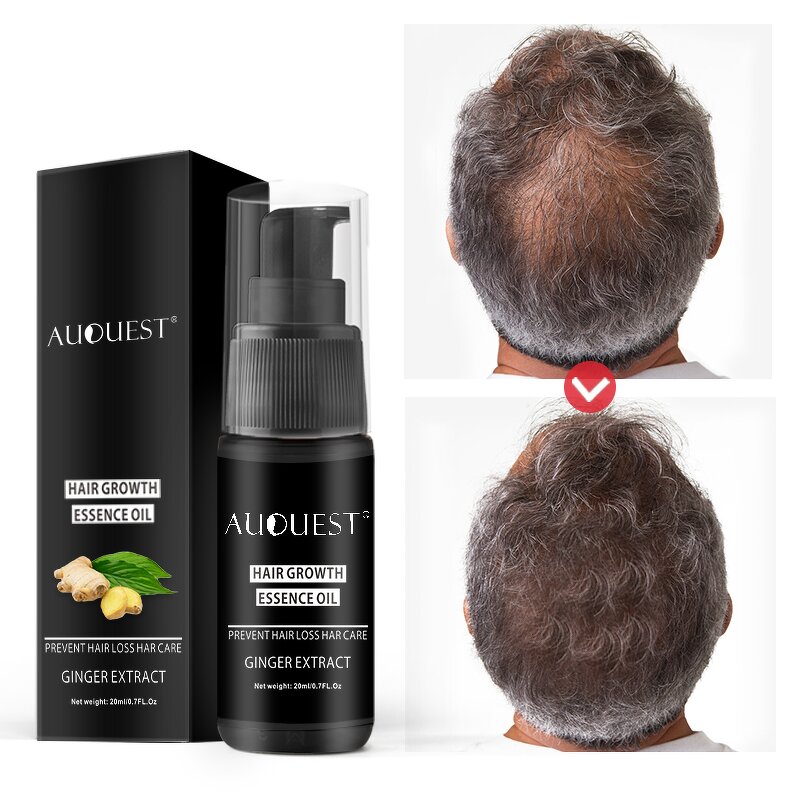 Hair Growth Serum - Factory - AuQuest Best Natural Smoothing Fast Organic Private Label Hair Oil