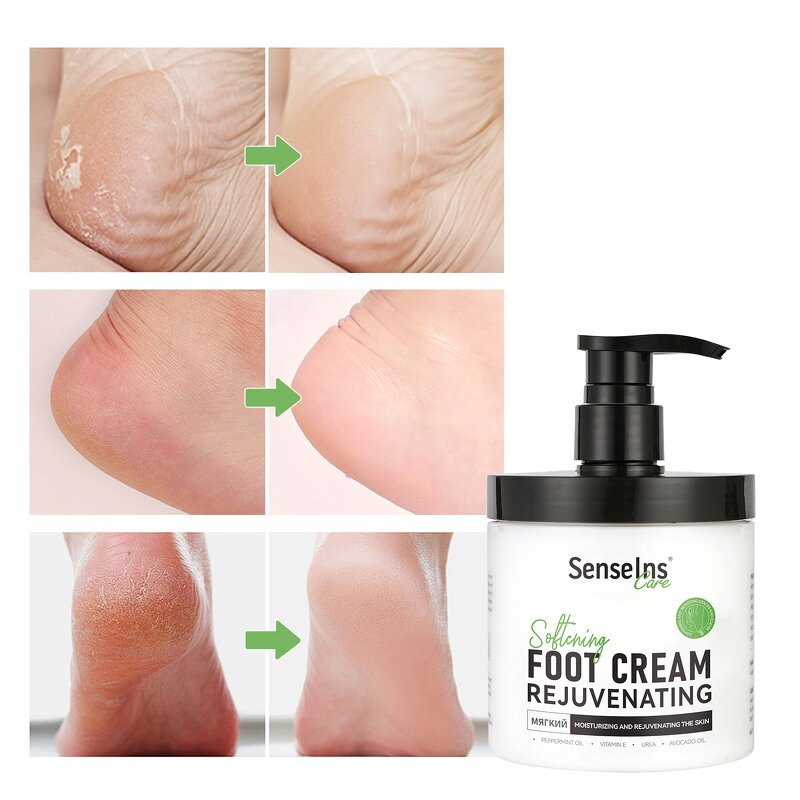 Urea Foot Cream - Factory - Hot Selling Private Label Organic Intensive Nourishing Hydrating Repair Cream