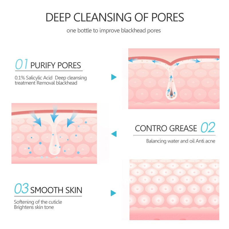 Salicylic Acid Clay Mask - Factory - Hot Selling Natural Organic Anti Aging Acne Whitening Facial Mud Mask