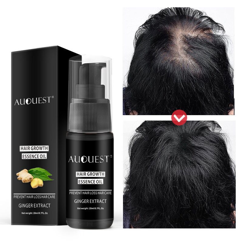 Hair Growth Serum - Factory - AuQuest Best Natural Smoothing Fast Organic Private Label Hair Oil