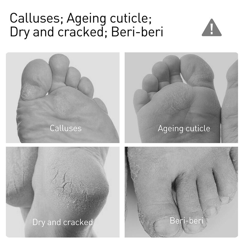 Foot Peeling Spray - Manufacturer - Hot Selling Organic Nourishing Moisturizing Dead Skin Exfoliating Spray