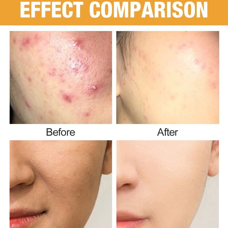 Vitamin C Fruit Serum - Manufacturer - Wholesale Private Label Organic Papaya Turmeric Watermelon Extract