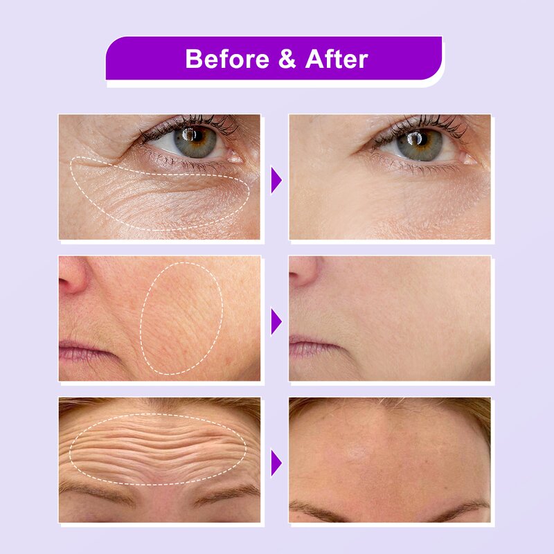 Retinol Bakuchiol Serum - Factory - Wholesale 3% Organic Anti Aging Reduce Fine Line Anti Wrinkle Serum