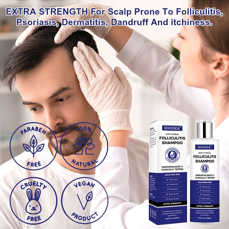 Anti-Fungal Shampoo Manufacturer - Hot Sale for Itchy Dry Scalp & Folliculitis