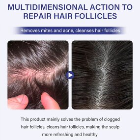 Scalp Psoriasis Shampoo Manufacturer - Spot Product with Tea Tree Oil for Relief