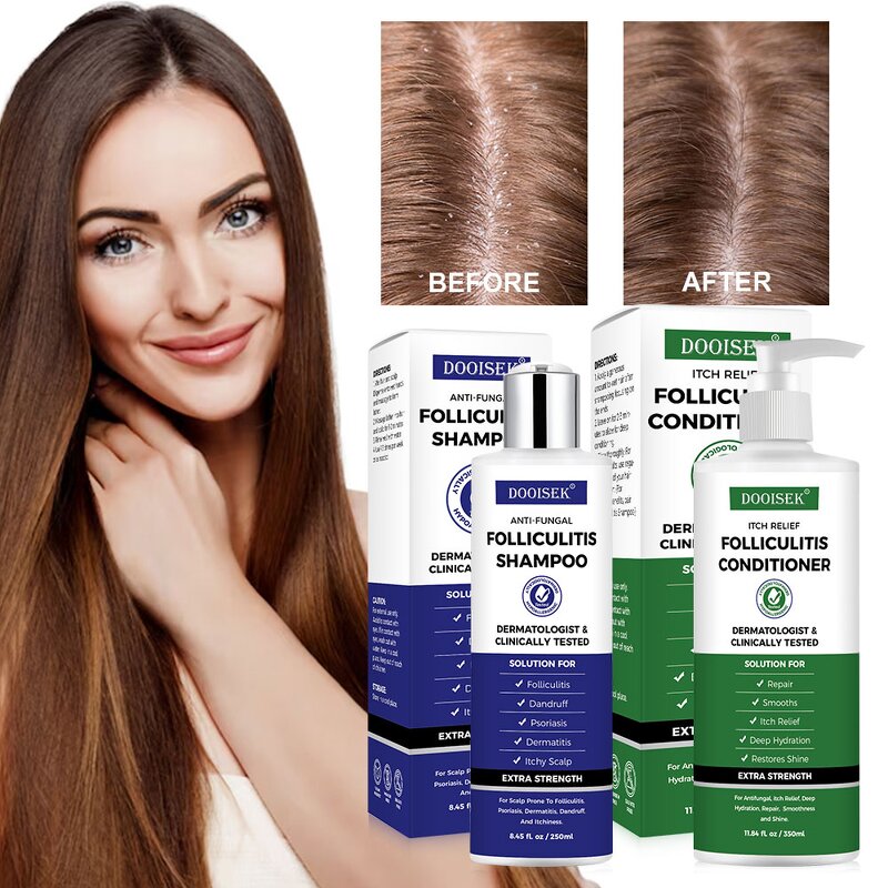 Anti Pruritic Shampoo Manufacturer - Best Selling for Seborrheic Dermatitis