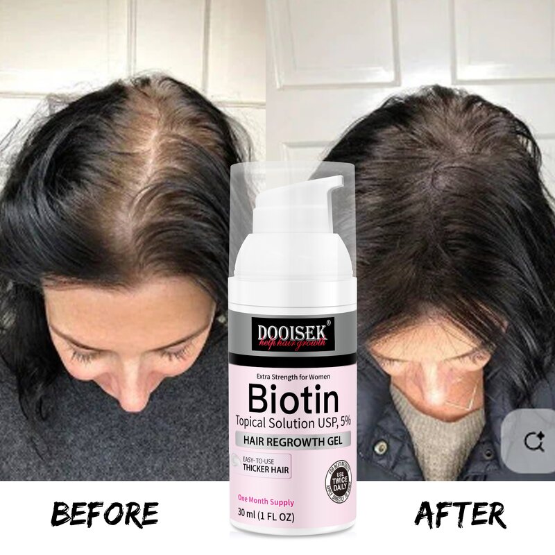 Hair Loss Treatment Serum Manufacturer - New Fashion 30ml with Biotin & Green Tea