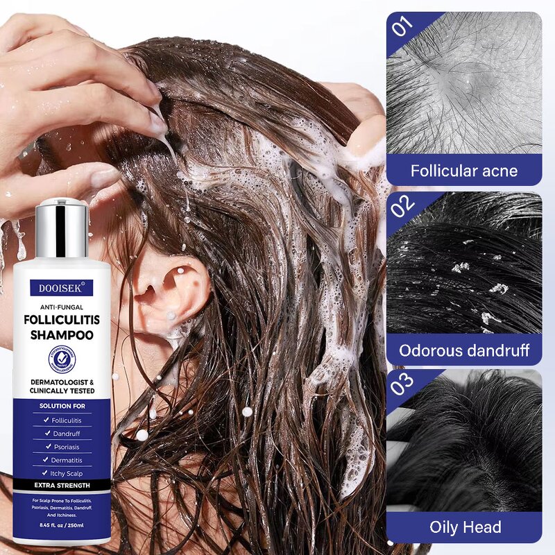 Anti-Dandruff Shampoo Manufacturer - Herbal Anti-Fungal for Dry Scalps