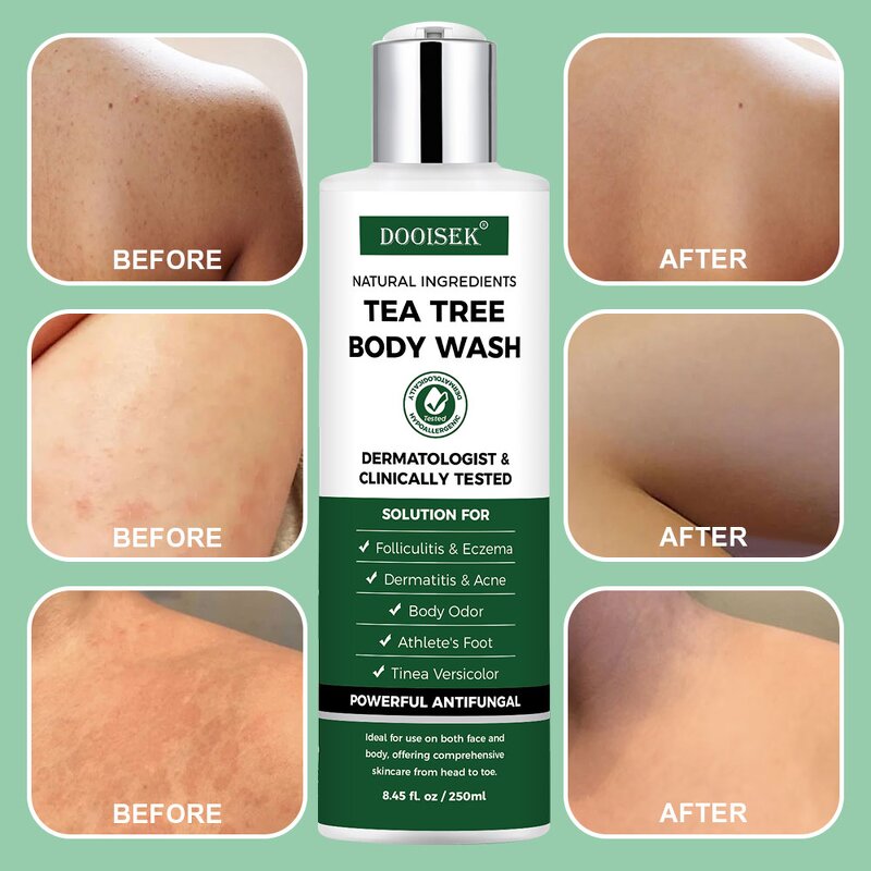 Scalp Psoriasis Shampoo Manufacturer - Spot Wholesale Organic Natural Moisturizing